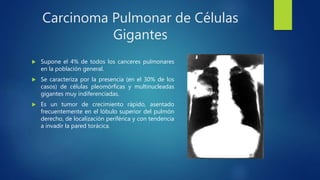 Carcinoma Pulmonar de Células
Gigantes
 Supone el 4% de todos los canceres pulmonares
en la población general.
 Se caracteriza por la presencia (en el 30% de los
casos) de células pleomórficas y multinucleadas
gigantes muy indiferenciadas.
 Es un tumor de crecimiento rápido, asentado
frecuentemente en el lóbulo superior del pulmón
derecho, de localización periférica y con tendencia
a invadir la pared torácica.
 