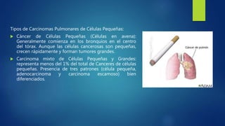 Tipos de Carcinomas Pulmonares de Células Pequeñas:
 Cáncer de Células Pequeñas (Células en avena):
Generalmente comienza en los bronquios en el centro
del tórax. Aunque las células cancerosas son pequeñas,
crecen rápidamente y forman tumores grandes.
 Carcinoma mixto de Células Pequeñas y Grandes:
representa menos del 1% del total de Canceres de células
pequeñas. Presencia de tres patrones (célula pequeña,
adenocarcinoma y carcinoma escamoso) bien
diferenciados.
 