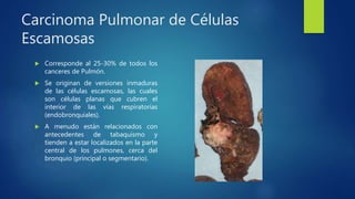 Carcinoma Pulmonar de Células
Escamosas
 Corresponde al 25-30% de todos los
canceres de Pulmón.
 Se originan de versiones inmaduras
de las células escamosas, las cuales
son células planas que cubren el
interior de las vías respiratorias
(endobronquiales).
 A menudo están relacionados con
antecedentes de tabaquismo y
tienden a estar localizados en la parte
central de los pulmones, cerca del
bronquio (principal o segmentario).
 