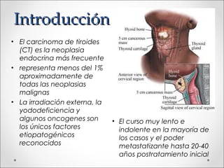 Introducción
• El carcinoma de tiroides
  (CT) es la neoplasia
  endocrina más frecuente
• representa menos del 1%
  aproximadamente de
  todas las neoplasias
  malignas
• La irradiación externa, la
  yododeficiencia y
  algunos oncogenes son        • El curso muy lento e
  los únicos factores            indolente en la mayoría de
  etiopatogénicos                los casos y el poder
  reconocidos                    metastatizante hasta 20-40
                                 años postratamiento inicial
 
