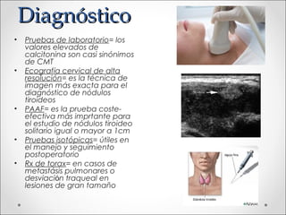 Diagnóstico
•   Pruebas de laboratorio= los
    valores elevados de
    calcitonina son casi sinónimos
    de CMT
•   Ecografía cervical de alta
    resolución= es la técnica de
    imagen más exacta para el
    diagnóstico de nódulos
    tiroideos
•   PAAF= es la prueba coste-
    efectiva más imprtante para
    el estudio de nódulos tiroideo
    solitario igual o mayor a 1cm
•   Pruebas isotópicas= útiles en
    el manejo y seguimiento
    postoperatorio
•   Rx de torax= en casos de
    metastásis pulmonares o
    desviaciόn traqueal en
    lesiones de gran tamaño
 