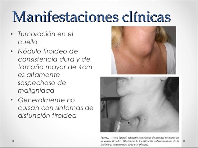 Si duele los riñones y las separaciones de la vagina