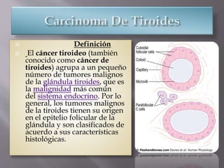  Definición
 El cáncer tiroideo (también
conocido como cáncer de
tiroides) agrupa a un pequeño
número de tumores malignos
de la glándula tiroides, que es
la malignidad más común
del sistema endocrino. Por lo
general, los tumores malignos
de la tiroides tienen su origen
en el epitelio folicular de la
glándula y son clasificados de
acuerdo a sus características
histológicas.
 