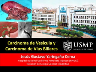 Carcinoma de Vesícula y
Carcinoma de Vías Biliares
Jesús Gustavo Yaringaño Cerna
Hospital Nacional Guillermo Almenara Irigoyen (HNGAI)
Rotación de Cirugía General y Digestiva
 