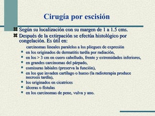 Cirugía por escisión 
c Según su localización coonn ssuu mmaarrggeenn ddee 11 aa 11..55 ccmmss.. 
DDeessppuuééss ddee llaa eexxttiirrppaacciióónn ssee eeffeeccttúúaa hhiissttoollóóggiiccoo ppoorr 
ccoonnggeellaacciióónn.. EEss úúttiill eenn:: 
ccaarrcciinnoommaass lliinneeaalleess ppaarraalleellooss aa llooss pplliieegguueess ddee eexxpprreessiióónn 
 eenn llooss oorriiggiinnaaddooss ddee ddeerrmmaattiittiiss ttaarrddííaa ppoorr rraaddiiaacciióónn,, 
 eenn llooss >> 33 ccmm eenn ccuueerroo ccaabbeelllluuddoo,, ffrreennttee yy eexxttrreemmiiddaaddeess iinnffeerriioorreess,, 
 eenn ggrraannddeess ccaarrcciinnoommaass ddeell ppáárrppaaddoo,, 
 ccoommiissuurraass llaabbiiaalleess ((pprreesseerrvvaa llaa ffuunncciióónn)),, 
 eenn llooss qquuee iinnvvaaddeenn ccaarrttííllaaggoo oo hhuueessoo ((llaa rraaddiiootteerraappiiaa pprroodduuccee 
nneeccrroossiiss ttaarrddííaa)),, 
 llooss oorriiggiinnaaddooss eenn cciiccaattrriicceess 
 úúllcceerraass oo ffííssttuullaass 
 eenn llooss ccaarrcciinnoommaass ddee ppeennee,, vvuullvvaa yy aannoo.. 
 