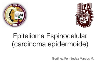 Epitelioma Espinocelular
(carcinoma epidermoide)
Godínez Fernández Marcos M.
 