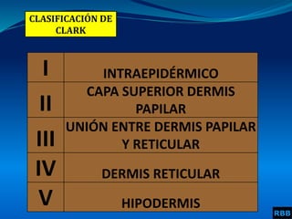 CLASIFICACIÓN DE
CLARK
I INTRAEPIDÉRMICO
II
CAPA SUPERIOR DERMIS
PAPILAR
III
UNIÓN ENTRE DERMIS PAPILAR
Y RETICULAR
IV DERMIS RETICULAR
V HIPODERMIS
RBB
 