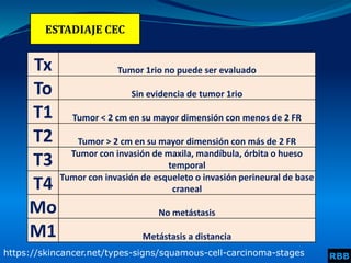 ESTADIAJE CEC
Tx Tumor 1rio no puede ser evaluado
To Sin evidencia de tumor 1rio
T1 Tumor < 2 cm en su mayor dimensión con menos de 2 FR
T2 Tumor > 2 cm en su mayor dimensión con más de 2 FR
T3 Tumor con invasión de maxila, mandíbula, órbita o hueso
temporal
T4 Tumor con invasión de esqueleto o invasión perineural de base
craneal
Mo No metástasis
M1 Metástasis a distancia
https://skincancer.net/types-signs/squamous-cell-carcinoma-stages RBB
 