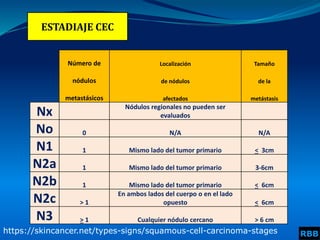ESTADIAJE CEC
https://skincancer.net/types-signs/squamous-cell-carcinoma-stages
Número de Localización Tamaño
nódulos de nódulos de la
metastásicos afectados metástasis
Nx Nódulos regionales no pueden ser
evaluados
No 0 N/A N/A
N1 1 Mismo lado del tumor primario < 3cm
N2a 1 Mismo lado del tumor primario 3-6cm
N2b 1 Mismo lado del tumor primario < 6cm
N2c > 1
En ambos lados del cuerpo o en el lado
opuesto < 6cm
N3 > 1 Cualquier nódulo cercano > 6 cm
RBB
 