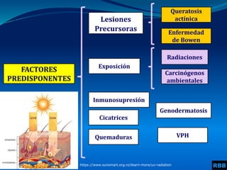 FACTORES
PREDISPONENTES
Lesiones
Precursoras
Queratosis
actínica
Radiaciones
Exposición
Enfermedad
de Bowen
Carcinógenos
ambientales
Inmunosupresión
Cicatrices
Quemaduras
Genodermatosis
VPH
https://www.sunsmart.org.nz/learn-more/uv-radiation RBB
 