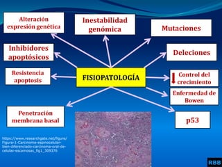 FISIOPATOLOGÍA
Inestabilidad
genómica Mutaciones
Resistencia
apoptosis
Control del
crecimiento
p53
Penetración
membrana basal
Alteración
expresión genética
Deleciones
Inhibidores
apoptósicos
Enfermedad de
Bowen
https://www.researchgate.net/figure/
Figura-1-Carcinoma-espinocelular-
bien-diferenciado-carcinoma-oral-de-
celulas-escamosas_fig1_309376
RBB
 