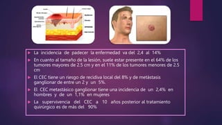  La incidencia de padecer la enfermedad va del 2,4 al 14%
 En cuanto al tamaño de la lesión, suele estar presente en el 64% de los
tumores mayores de 2.5 cm y en el 11% de los tumores menores de 2.5
cm
 El CEC tiene un riesgo de recidiva local del 8% y de metástasis
ganglionar de entre un 2 y un 5%.
 El CEC metastásico ganglionar tiene una incidencia de un 2,4% en
hombres y de un 1,1% en mujeres
 La supervivencia del CEC a 10 años posterior al tratamiento
quirúrgico es de más del 90%
 