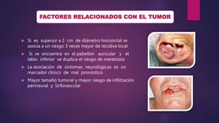 Si es superior a 2 cm de diámetro horizontal se
asocia a un riesgo 3 veces mayor de recidiva local
 Si se encuentra en el pabellón auricular y el
labio inferior se duplica el riesgo de metástasis
 La asociación de síntomas neurológicos es un
marcador clínico de mal pronóstico
 Mayor tamaño tumoral y mayor riesgo de infiltración
perineural y linfovascular
FACTORES RELACIONADOS CON EL TUMOR
 