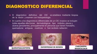 DIAGNOSTICO DIFERENCIAL
 El diagnóstico definitivo del CEC se establece mediante biopsia
de la lesión y examen con histop...