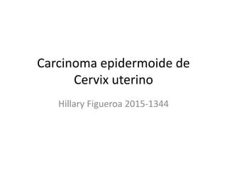 Carcinoma epidermoide de
Cervix uterino
Hillary Figueroa 2015-1344
 