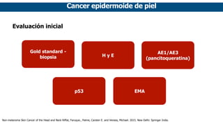 Cancer epidermoide de piel
Evaluación inicial
p53
H y E
Gold standard -
biopsia
AE1/AE3
(pancitoqueratina)
EMA
Non-melanoma Skin Cancer of the Head and Neck Riffat, Faruque., Palme, Carsten E. and Veness, Michael. 2015. New Delhi: Springer India.
 