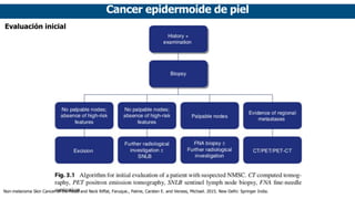Cancer epidermoide de piel
Evaluación inicial
Non-melanoma Skin Cancer of the Head and Neck Riffat, Faruque., Palme, Carsten E. and Veness, Michael. 2015. New Delhi: Springer India.
 