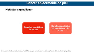 Cancer epidermoide de piel
Metástasis ganglionar
Ganglios parotídeos
60 - 82%
Ganglios cervicales
no parotídeos 18 -
41%
Non-melanoma Skin Cancer of the Head and Neck Riffat, Faruque., Palme, Carsten E. and Veness, Michael. 2015. New Delhi: Springer India.
 