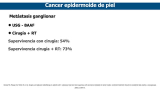 Cancer epidermoide de piel
Metástasis ganglionar
• USG - BAAF
• Cirugía + RT
Supervivencia con cirugía: 54%
Supervivencia cirugía + RT: 73%
Veness MJ, Morgan GJ, Palme CE, et al. Surgery and adjuvant radiotherapy in patients with cutaneous head and neck squamous cell carcinoma metastatic to lymph nodes: combined treatment should be considered best practice. Laryngoscope.
2005;115:870–5.
 