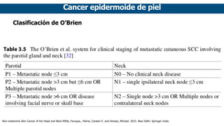 Cancer epidermoide de piel
Clasificación de O’Brien
Non-melanoma Skin Cancer of the Head and Neck Riffat, Faruque., Palme, Carsten E. and Veness, Michael. 2015. New Delhi: Springer India.
 