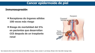 Cancer epidermoide de piel
Inmunosupresión
• Receptores de órganos sólidos
100 veces más riesgo
• Riesgo de mortalidad del 5%
en pacientes que desarrollan
CCE después de un trasplante
renal
Non-melanoma Skin Cancer of the Head and Neck Riffat, Faruque., Palme, Carsten E. and Veness, Michael. 2015. New Delhi: Springer India.
 