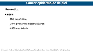 Cancer epidermoide de piel
Pronóstico
• EGFR
Mal pronóstico
79% primarios metastatizaron
43% metástasis
Non-melanoma Skin Cancer of the Head and Neck Riffat, Faruque., Palme, Carsten E. and Veness, Michael. 2015. New Delhi: Springer India.
 