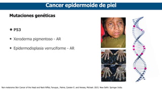 Cancer epidermoide de piel
Mutaciones genéticas
• P53
• Xeroderma pigmentoso - AR
• Epidermodisplasia verruciforme - AR
Non-melanoma Skin Cancer of the Head and Neck Riffat, Faruque., Palme, Carsten E. and Veness, Michael. 2015. New Delhi: Springer India.
 