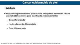 Cancer epidermoide de piel
Histología
• El grado de pleomorfismo y desviación del epitelio escamoso se han
usado históricamente para clasificarlo subjetivamente:
➡ Bien diferenciado
➡ Moderadamente diferenciado
➡ Podo diferenciado
Non-melanoma Skin Cancer of the Head and Neck Riffat, Faruque., Palme, Carsten E. and Veness, Michael. 2015. New Delhi: Springer India.
 
