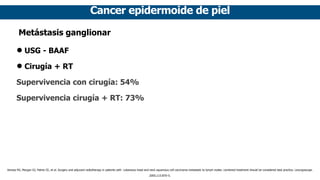 Cancer epidermoide de piel
Metástasis ganglionar
• USG - BAAF
• Cirugía + RT
Supervivencia con cirugía: 54%
Supervivencia ...