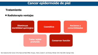 Cancer epidermoide de piel
Tratamiento
• Radioterapia ventajas
Disminuye
morbilidad quirúrgica
Cosmética
Ancianos y
comorb...