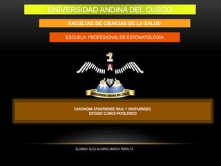 FACULTAD DE CIENCIAS DE LA SALUD
ESCUELA PROFESIONAL DE ESTOMATOLOGIA
CARCINOMA EPIDERMOIDE ORAL Y OROFARÍNGEO.
ESTUDIO CLÍNICO-PATOLÓGICO
ALUMNO: ALEX ALVARO LIMACHI PERALTA
UNIVERSIDAD ANDINA DEL CUSCO
 