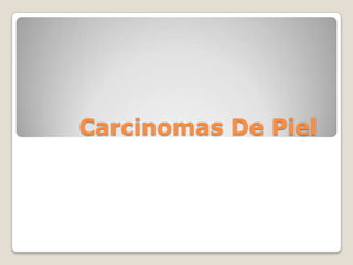Carcinomas De Piel	 