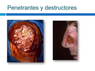 Penetrantes y destructores
 