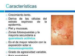 Características
   Crecimiento lento.
   Deriva de las células del
    estrato    espinoso    de    la
    epidermis.
   Piel y mucosas.
   Zonas fotoexpuestas y la
    mayoría secundaria a
    queratosis actínica.
   Es el de mayor relación con la
    exposición solar e
    inmunosupresión.
   Grado de agresividad variable.
 