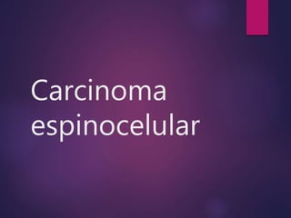 Carcinoma
espinocelular
 