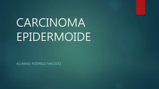 CARCINOMA 
EPIDERMOIDE 
ALUMNO: RODRIGO MACEDO 
 