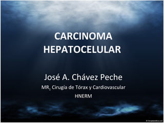 CARCINOMA HEPATOCELULAR  José A. Chávez Peche MR 1  Cirugía de Tórax y Cardiovascular HNERM 