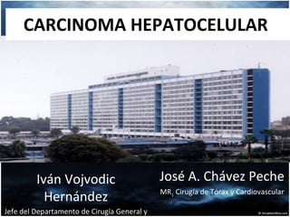 CARCINOMA HEPATOCELULAR  José A. Chávez Peche MR 1  Cirugía de Tórax y Cardiovascular Iván Vojvodic Hernández Jefe del Departamento de Cirugía General y Digestiva 