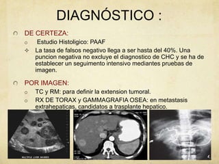 DIAGNÓSTICO :
DE CERTEZA:
o Estudio Histoligico: PAAF
 La tasa de falsos negativo llega a ser hasta del 40%. Una
puncion negativa no excluye el diagnostico de CHC y se ha de
establecer un seguimento intensivo mediantes pruebas de
imagen.
POR IMAGEN:
o TC y RM: para definir la extension tumoral.
o RX DE TORAX y GAMMAGRAFIA OSEA: en metastasis
extrahepaticas, candidatos a trasplante hepatico.
 