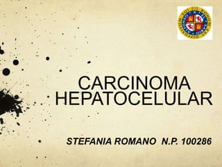 CARCINOMA
HEPATOCELULAR
STEFANIA ROMANO N.P. 100286
 