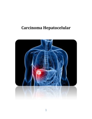 Carcinoma Hepatocelular

1

 