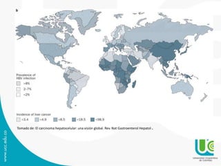 Tomado de: El carcinoma hepatocelular: una visión global. Rev. Nat Gastroenterol Hepatol .
 