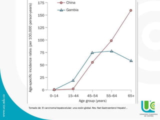 Carcinoma hepatocelular caso clinico
