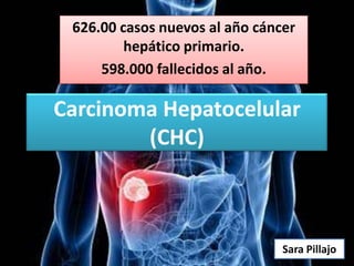 626.00 casos nuevos al año cáncer
hepático primario.
598.000 fallecidos al año.

Carcinoma Hepatocelular
(CHC)

Sara Pillajo

 
