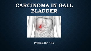 CARCINOMA IN GALL
BLADDER
Presented by :- NK
 