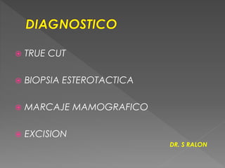  TRUE CUT
 BIOPSIA ESTEROTACTICA
 MARCAJE MAMOGRAFICO
 EXCISION
DR. S RALON
 