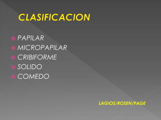  PAPILAR
 MICROPAPILAR
 CRIBIFORME
 SOLIDO
 COMEDO
LAGIOS/ROSEN/PAGE
 