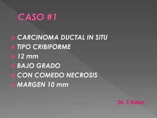  CARCINOMA DUCTAL IN SITU
 TIPO CRIBIFORME
 12 mm
 BAJO GRADO
 CON COMEDO NECROSIS
 MARGEN 10 mm
Dr. S Ralon
 