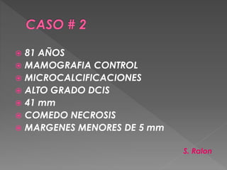  81 AÑOS
 MAMOGRAFIA CONTROL
 MICROCALCIFICACIONES
 ALTO GRADO DCIS
 41 mm
 COMEDO NECROSIS
 MARGENES MENORES DE 5 mm
S. Ralon
 