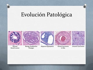 Evolución Patológica